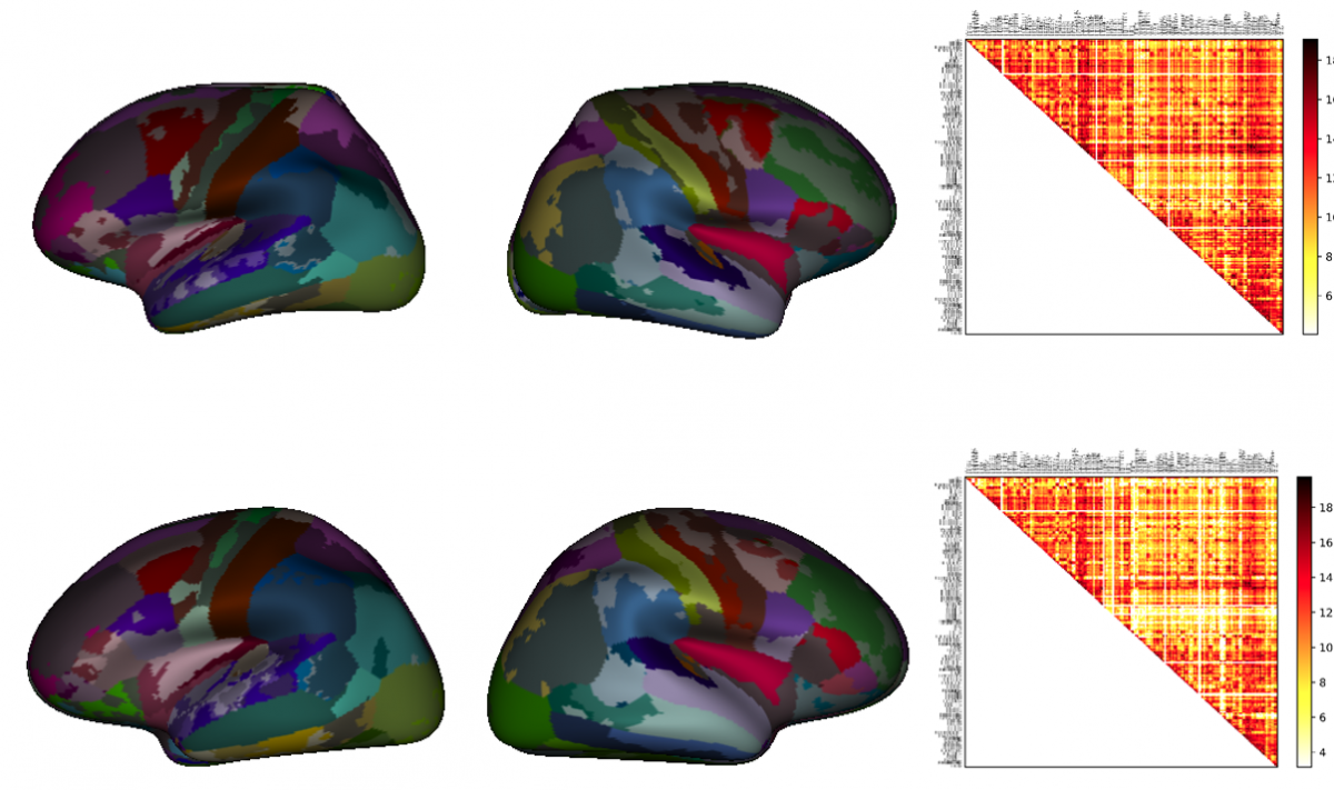 Figure 3 : Machine-learning-based tuning of the parcellation to individuals to achieve stable structural  connectomes 